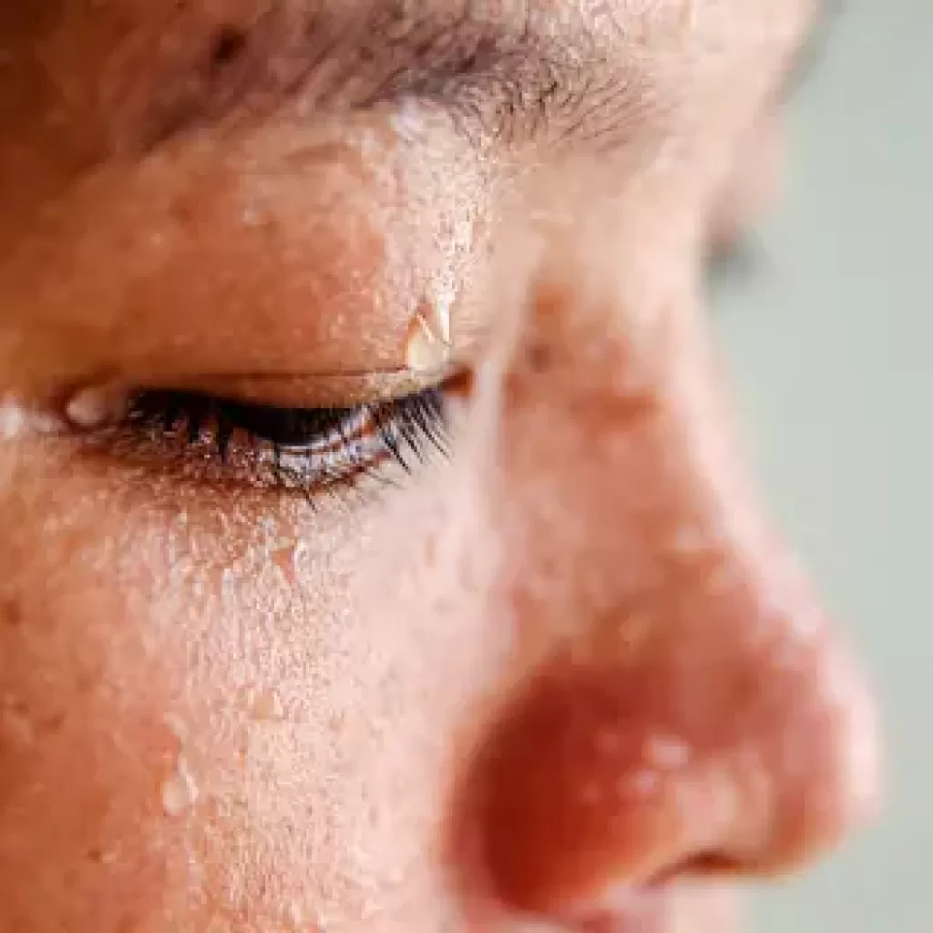 Tratamento da Hiperidrose Facial com Toxina Botulínica
