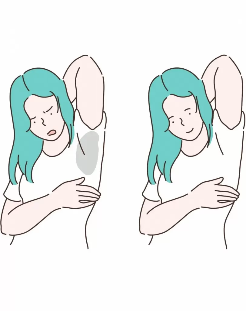 Como funciona a cirurgia que trata a hiperidrose?
